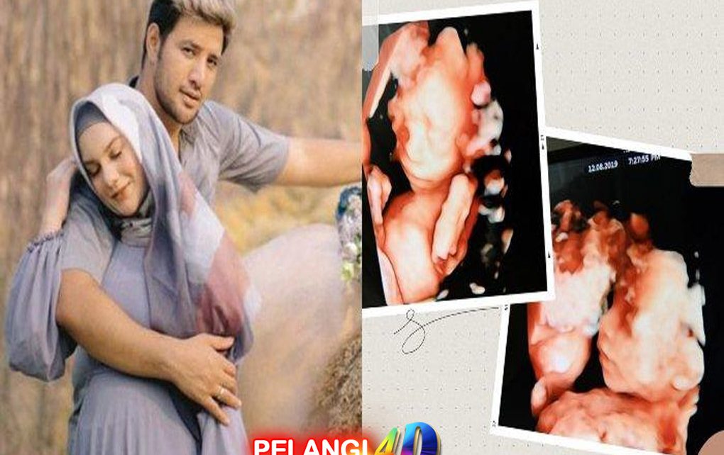 4 Fakta Meninggalnya Bayi Kembar Irish Bella dan Ammar Zoni