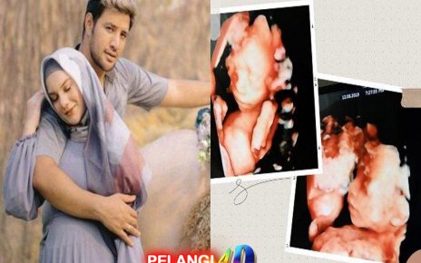 4 Fakta Meninggalnya Bayi Kembar Irish Bella dan Ammar Zoni